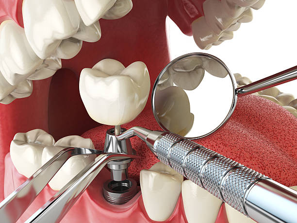 Best Emergency Dentist for Special Needs Patients in Ford Heights, IL